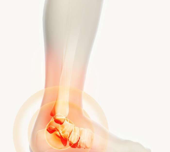 How to Avoid Ankle Injuries